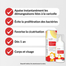 PoxClin® Varicelle
