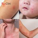 PoxClin® Démangeaisons